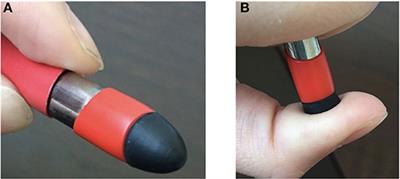 Phantom Sensations Influenced by Global and Local Modifications of the Prosthetic Socket as a Potential Solution for Natural Somatosensory Feedback During Walking: A Preliminary Study of a Single Case